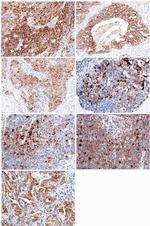 WFDC2 Antibody in Immunohistochemistry (Paraffin) (IHC (P))