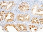 WFDC2 Antibody in Immunohistochemistry (Paraffin) (IHC (P))