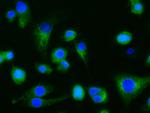 Dectin 1 (soluble) Antibody in Immunocytochemistry (ICC/IF)