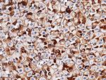 EpCAM Antibody in Immunohistochemistry (Paraffin) (IHC (P))