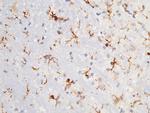 CD64 Antibody in Immunohistochemistry (Paraffin) (IHC (P))