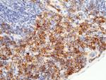 CD64 Antibody in Immunohistochemistry (Paraffin) (IHC (P))