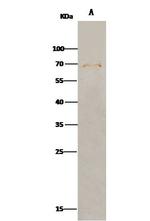 FGFR5 Antibody in Immunoprecipitation (IP)