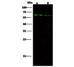 FGFR5 Antibody in Western Blot (WB)