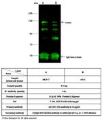 E-cadherin Antibody in Immunoprecipitation (IP)