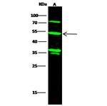 KYNU Antibody in Western Blot (WB)