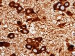 RAP Antibody in Immunohistochemistry (Paraffin) (IHC (P))