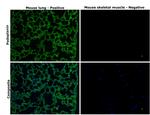 Podoplanin Antibody in Immunohistochemistry (Paraffin) (IHC (P))