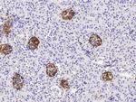 Podoplanin Antibody in Immunohistochemistry (Paraffin) (IHC (P))