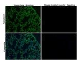 Podoplanin Antibody in Immunohistochemistry (Paraffin) (IHC (P))