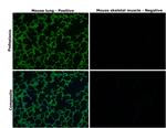 Podoplanin Antibody in Immunohistochemistry (Paraffin) (IHC (P))