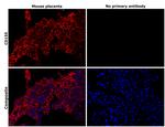 CD155 Antibody in Immunohistochemistry (Paraffin) (IHC (P))