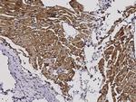 S100A1 Antibody in Immunohistochemistry (Paraffin) (IHC (P))