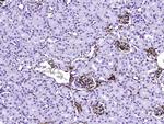 S100A6 Antibody in Immunohistochemistry (Paraffin) (IHC (P))