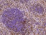 S100A6 Antibody in Immunohistochemistry (Paraffin) (IHC (P))