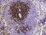 CD6 Antibody in Immunohistochemistry (Paraffin) (IHC (P))