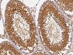 UCHL3 Antibody in Immunohistochemistry (Paraffin) (IHC (P))