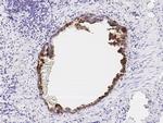 WFDC2 Antibody in Immunohistochemistry (Paraffin) (IHC (P))