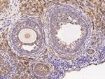 WFDC2 Antibody in Immunohistochemistry (Paraffin) (IHC (P))