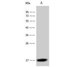 Dengue Virus Type 2 Capsid (strain New Guinea C) Antibody in Western Blot (WB)