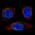 Emerin Antibody in Immunocytochemistry (ICC/IF)