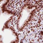 Emerin Antibody in Immunohistochemistry (Paraffin) (IHC (P))