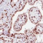 Emerin Antibody in Immunohistochemistry (Paraffin) (IHC (P))