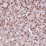 Emerin Antibody in Immunohistochemistry (Paraffin) (IHC (P))