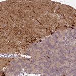 FABP7 Antibody in Immunohistochemistry (Paraffin) (IHC (P))