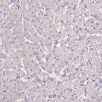 FABP7 Antibody in Immunohistochemistry (Paraffin) (IHC (P))