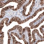 HMGCR Antibody in Immunohistochemistry (Paraffin) (IHC (P))