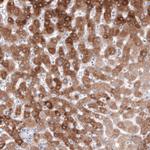 HMGCR Antibody in Immunohistochemistry (Paraffin) (IHC (P))