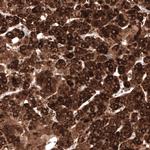 HMGCR Antibody in Immunohistochemistry (Paraffin) (IHC (P))