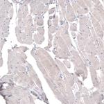 HMGCR Antibody in Immunohistochemistry (Paraffin) (IHC (P))