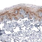 HMGCR Antibody in Immunohistochemistry (Paraffin) (IHC (P))