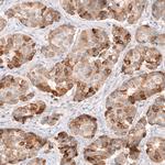 HMGCR Antibody in Immunohistochemistry (Paraffin) (IHC (P))