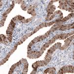 HMGCR Antibody in Immunohistochemistry (Paraffin) (IHC (P))