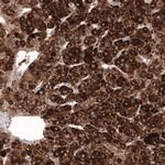 HMGCR Antibody in Immunohistochemistry (Paraffin) (IHC (P))