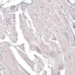 HMGCR Antibody in Immunohistochemistry (Paraffin) (IHC (P))