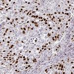 Anillin Antibody in Immunohistochemistry (Paraffin) (IHC (P))