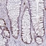 Anillin Antibody in Immunohistochemistry (Paraffin) (IHC (P))