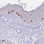 Anillin Antibody in Immunohistochemistry (Paraffin) (IHC (P))