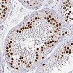 Anillin Antibody in Immunohistochemistry (Paraffin) (IHC (P))