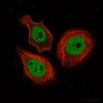 CTCF Antibody in Immunocytochemistry (ICC/IF)