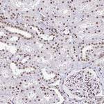 CTCF Antibody in Immunohistochemistry (Paraffin) (IHC (P))