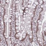 CTCF Antibody in Immunohistochemistry (Paraffin) (IHC (P))