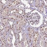 CTCF Antibody in Immunohistochemistry (Paraffin) (IHC (P))