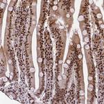 CTCF Antibody in Immunohistochemistry (Paraffin) (IHC (P))