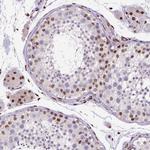 CTCF Antibody in Immunohistochemistry (Paraffin) (IHC (P))