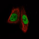 MEF2C Antibody in Immunocytochemistry (ICC/IF)